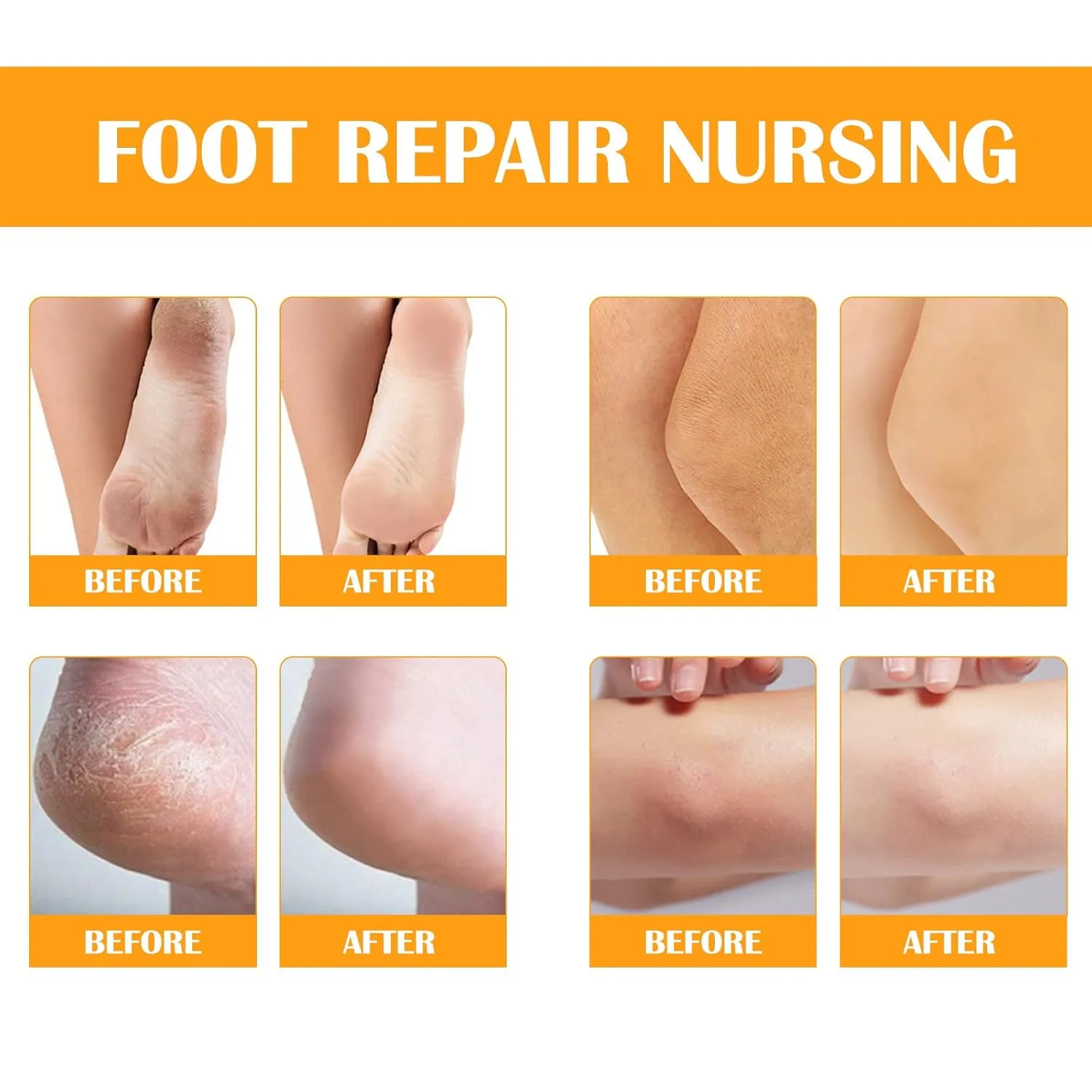 Callus Remover for Feet, Instant Foot Peeling Spray, Feet Scrubber Dead Skin Remover Cracked Heels Softener, Works Great with Any Foot File or Scrubber, Hydrating Exfoliating Spray (2 PCS,Orange)