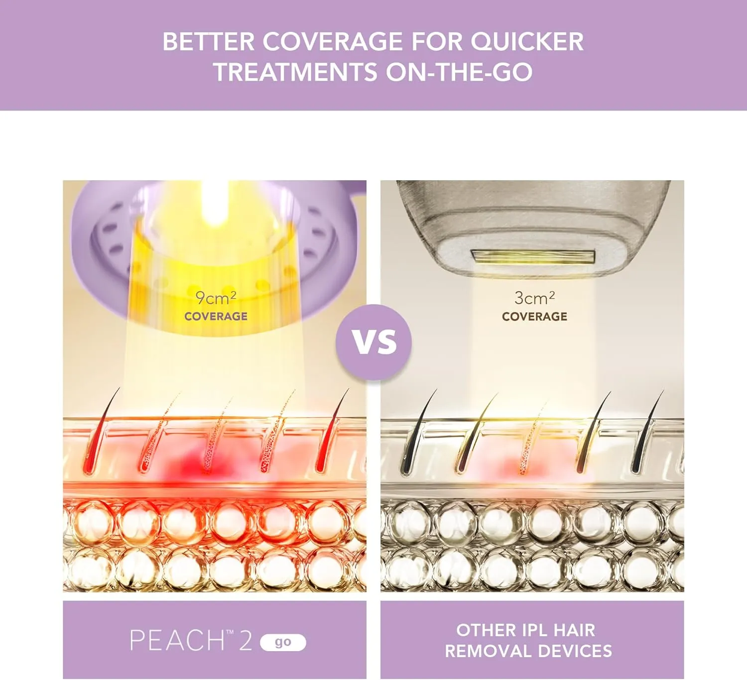 FOREO Peach 2 go IPL Hair Removal Device - Travel-Friendly Permanent Removal - Laser Treatment for Body & Face - Painless & Skin Cooling - Silicone Shield - Customizable - Lavander