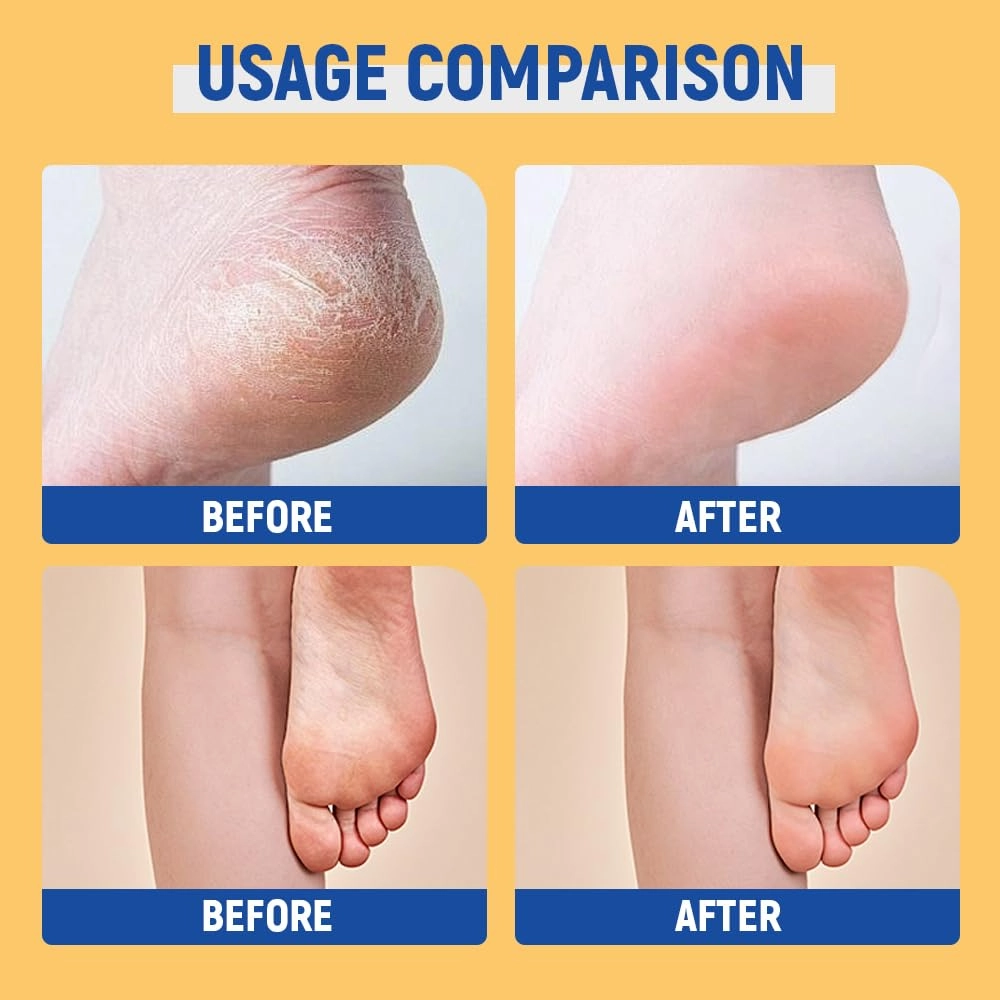Hydrating and Anti-Cracking Foot Cream,Intensive Foot Repair Cream Hand Care Stick Beauty Heel Balm Stick,Callus Remover Anti-Cracking Formula Foot Lotion for Moisturizing Skin (Blue/3pcs, 40g)