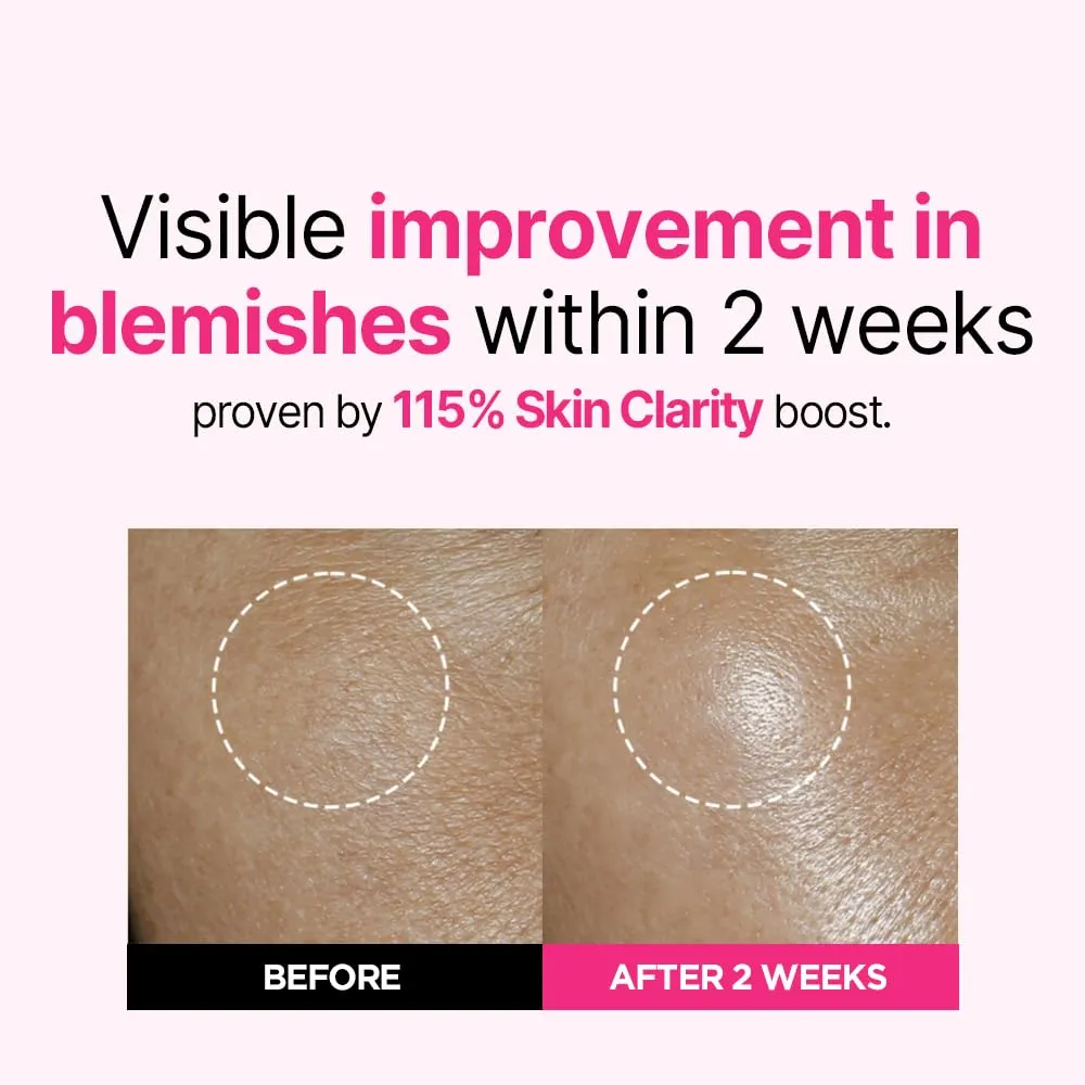 ISOI Blemish Care Up Serum, Vegan Hydrating Serum for Smooth & Glass Skin Effect, Skin Barrier & Moisture Balance, Korean Skin Care (2.36 fl. oz, 70ml)