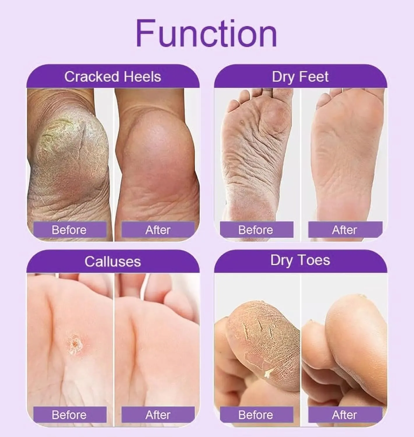 Maraly Foot Peeling Mask (2 Pairs) - Natural Ingredients, Removes Dead Skin & Calluses, Baby Soft Feet in 1 Week, 2-Pack, Exfoliating Foot Care Treatment for Men & Women (Lavender) (2 pack)