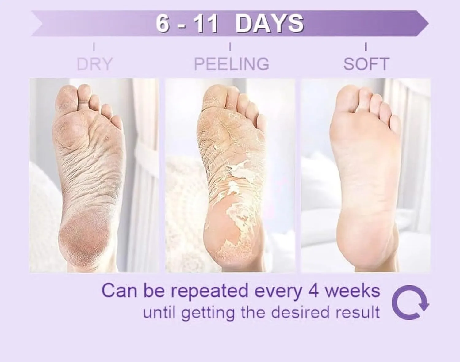Maraly Foot Peeling Mask (2 Pairs) - Natural Ingredients, Removes Dead Skin & Calluses, Baby Soft Feet in 1 Week, 2-Pack, Exfoliating Foot Care Treatment for Men & Women (Lavender) (2 pack)